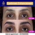 Thane Microblading Eyebrows by DNA Royal Aesthetic Clinic.